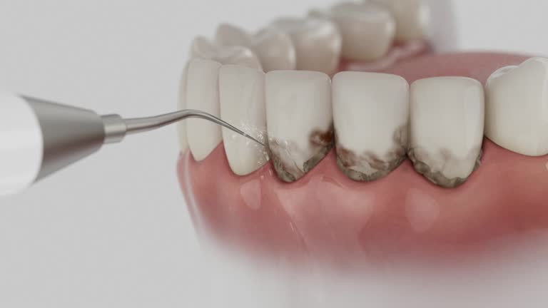 Reliable Dental contractor in Chapel Hill, NC by Dentist Open Now